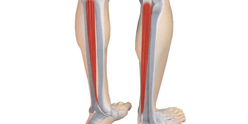 Disfunción del Tibial Posterior