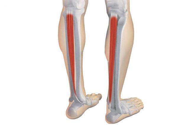 Disfunción del Tibial Posterior
