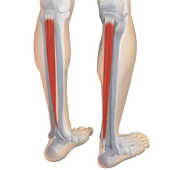 medeirosycabello_tibial_posterior Disfunción del Tibial Posterior