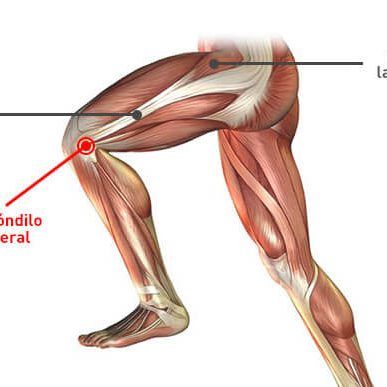 medeiroycabello_cintilla-iliotibial sindrome de la cinta iliotibial